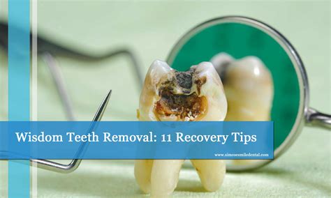 can i shower after wisdom teeth removal|What To Do After Wisdom Teeth Removal